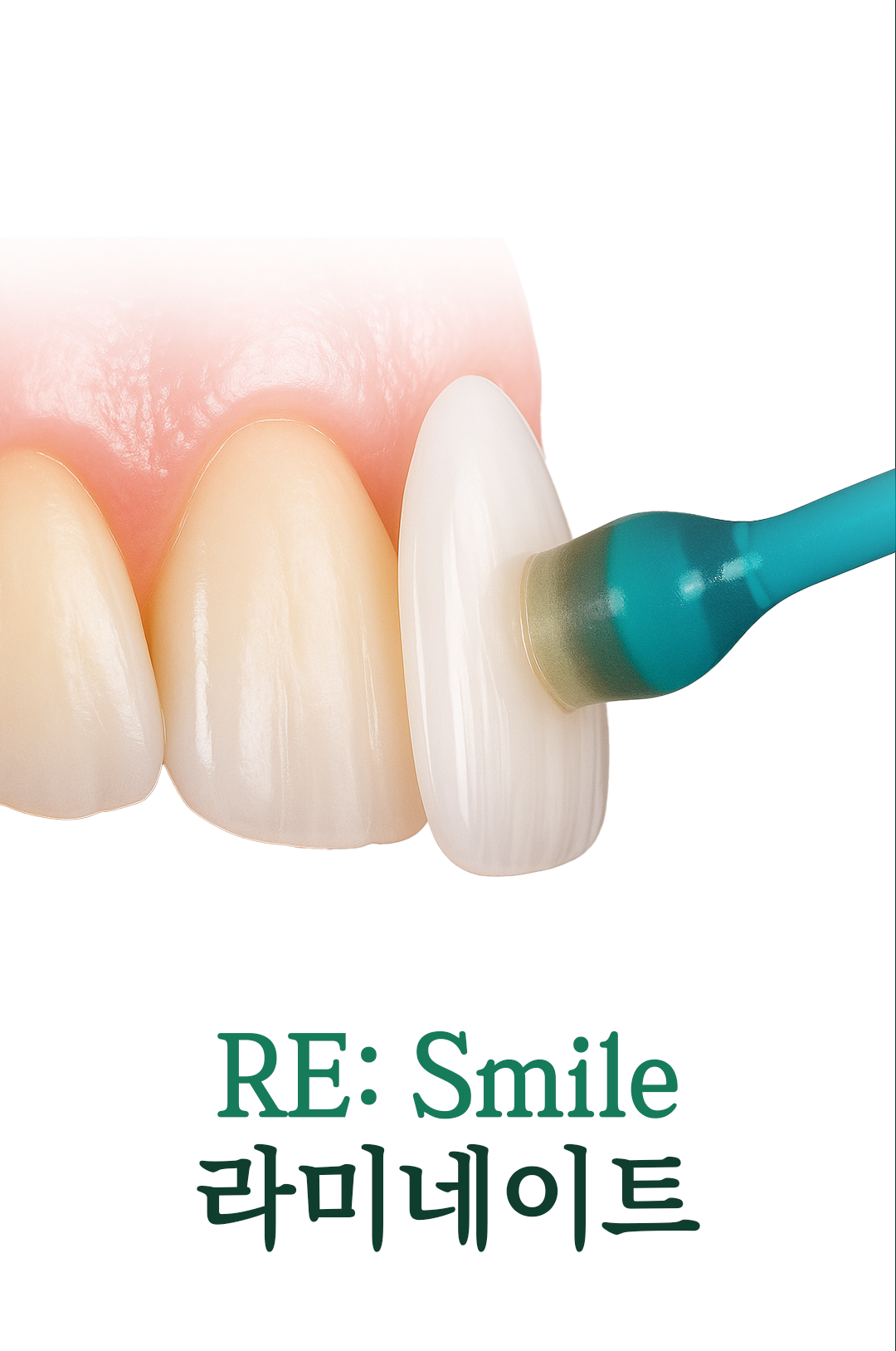 RE:Smile-라미네이트