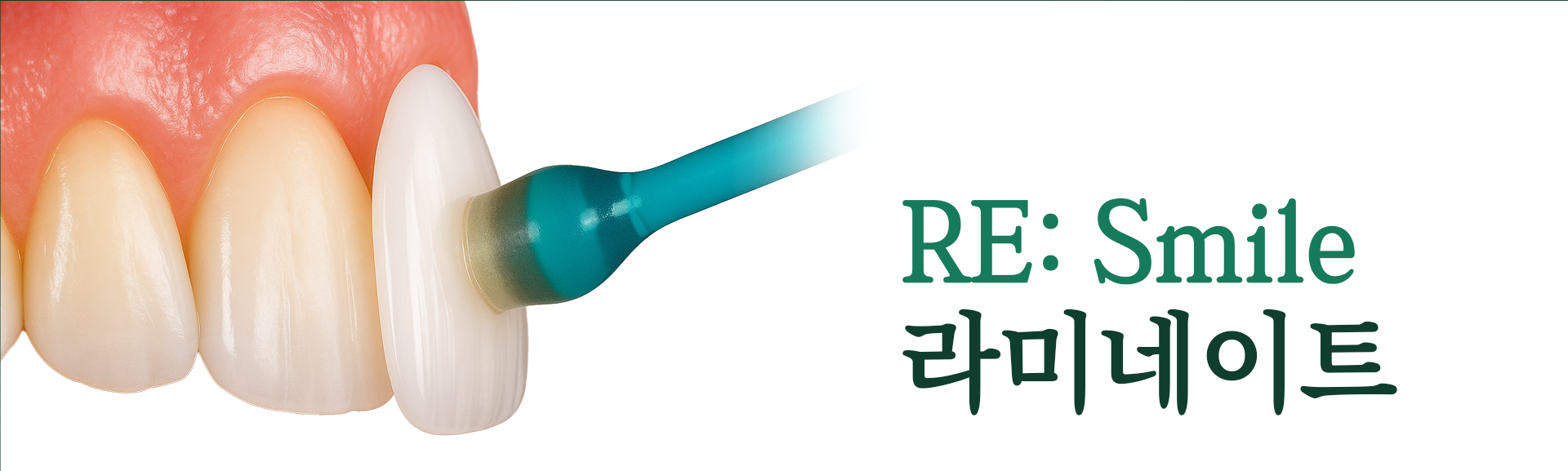 RE:Smile-라미네이트